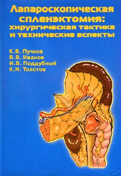 Спленомегалия - Гематология и онкология - Справочник MSD Профессиональная версия