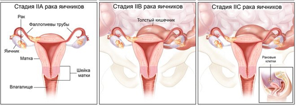 Лазерное омоложение (уменьшение) влагалища – лечение в Москве в клинике доктора Назимовой
