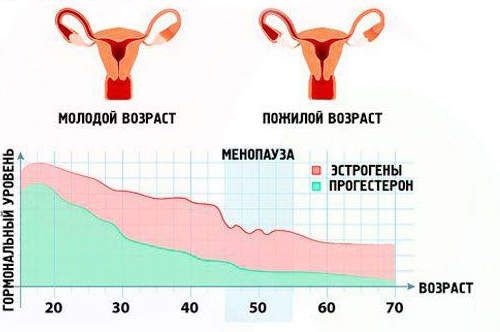 Гиперплазия эндометрия в постменопаузе