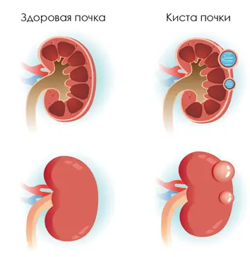 Миф о детоксе: чем опасен?